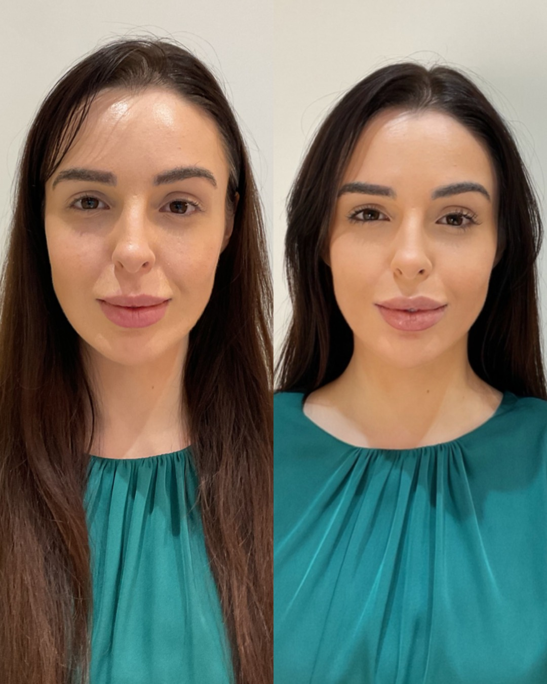 Antes e depois — resultado real 02